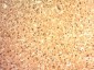  Glypican-3 (GPC3) (Hepatocellular Carcinoma Marker) Antibody - With BSA and Azide